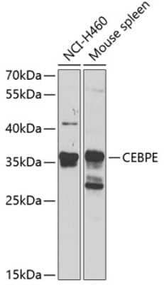 Western Blot: CEBP epsilon AntibodyBSA Free [NBP2-92530]